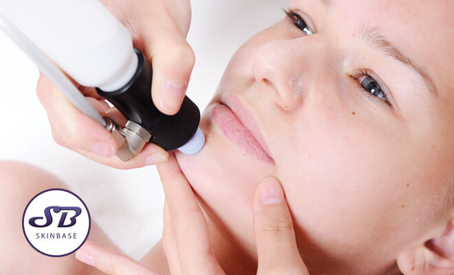 Are microdermabrasion results permanent