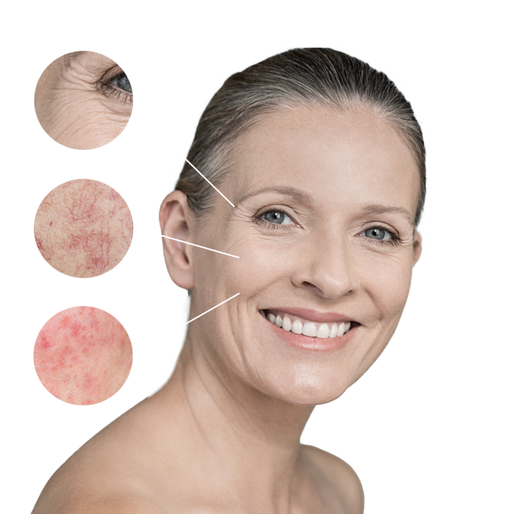 skin conditions